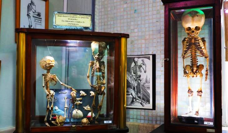 Dissections, Bones, and Wax Sculptures: A Look Inside the Museum Hidden on the First Floor of the School of Medicine, Now Open for a Free Guided Tour