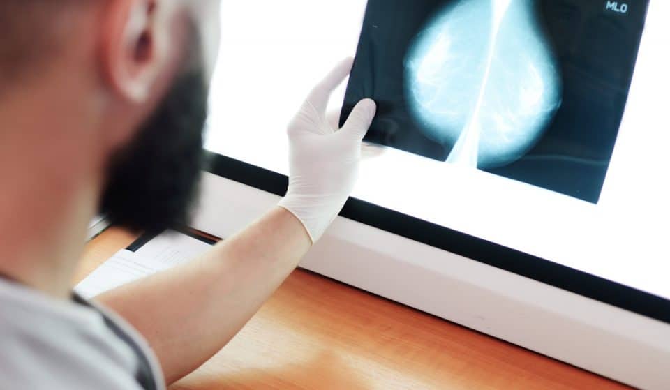 El Hospital del Mar da un paso de gigante en la lucha contra el cáncer de mama