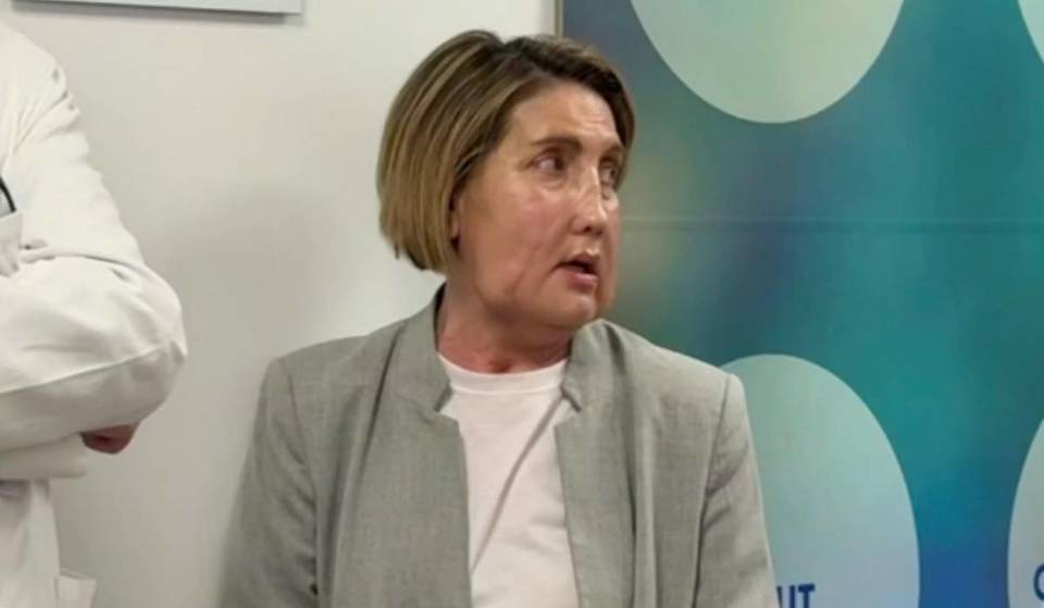 Vall d’Hebron marca um marco mundial: primeiro transplante facial graças a uma doadora por eutanásia
