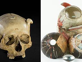 Oltre i costumi da festa: L&#8217;archivio silenzioso di Amsterdam di corpi reali e storia medica oscura