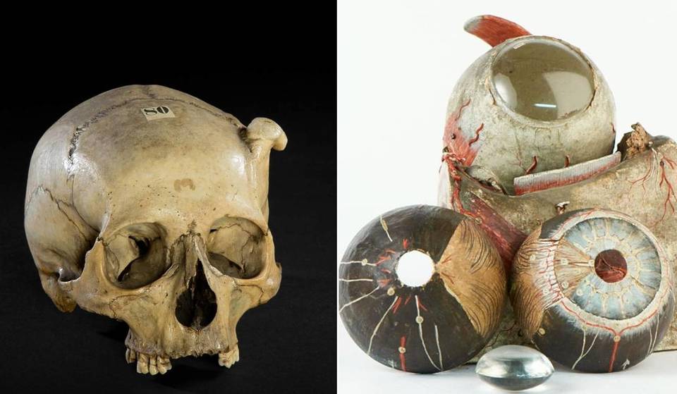 Más allá de los disfraces: El silencioso archivo de cuerpos reales y oscura historia médica de Ámsterdam