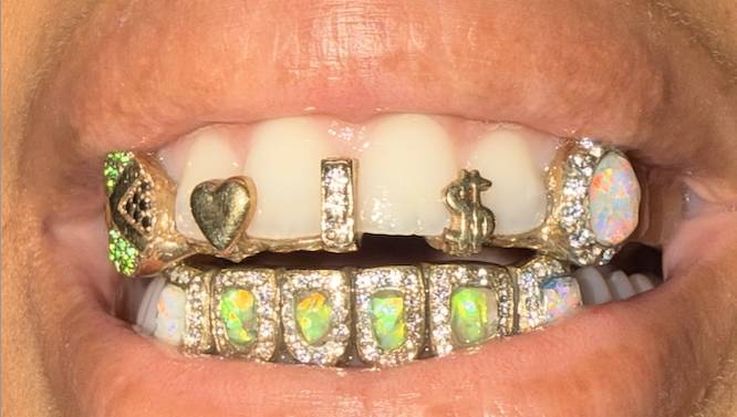 primer plano de los grillz en los dientes