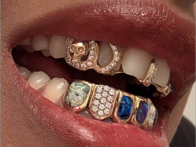 primer plano de los grillz en los dientes