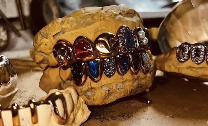 primer plano de los grillz en los dientes