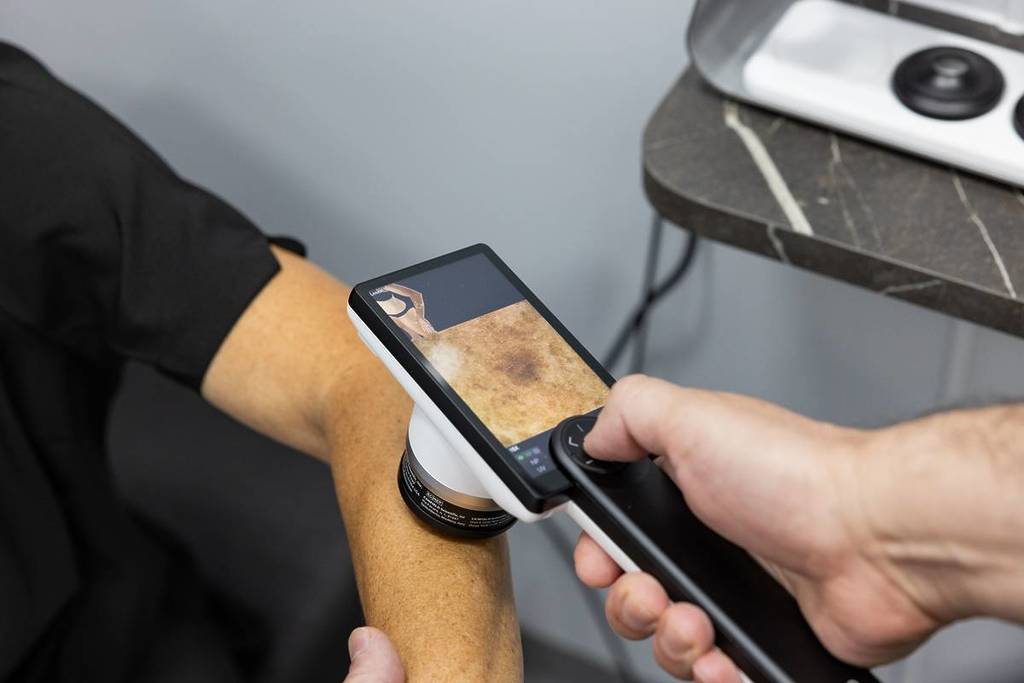 australian skin cancer foundation mobile clinic check vectra