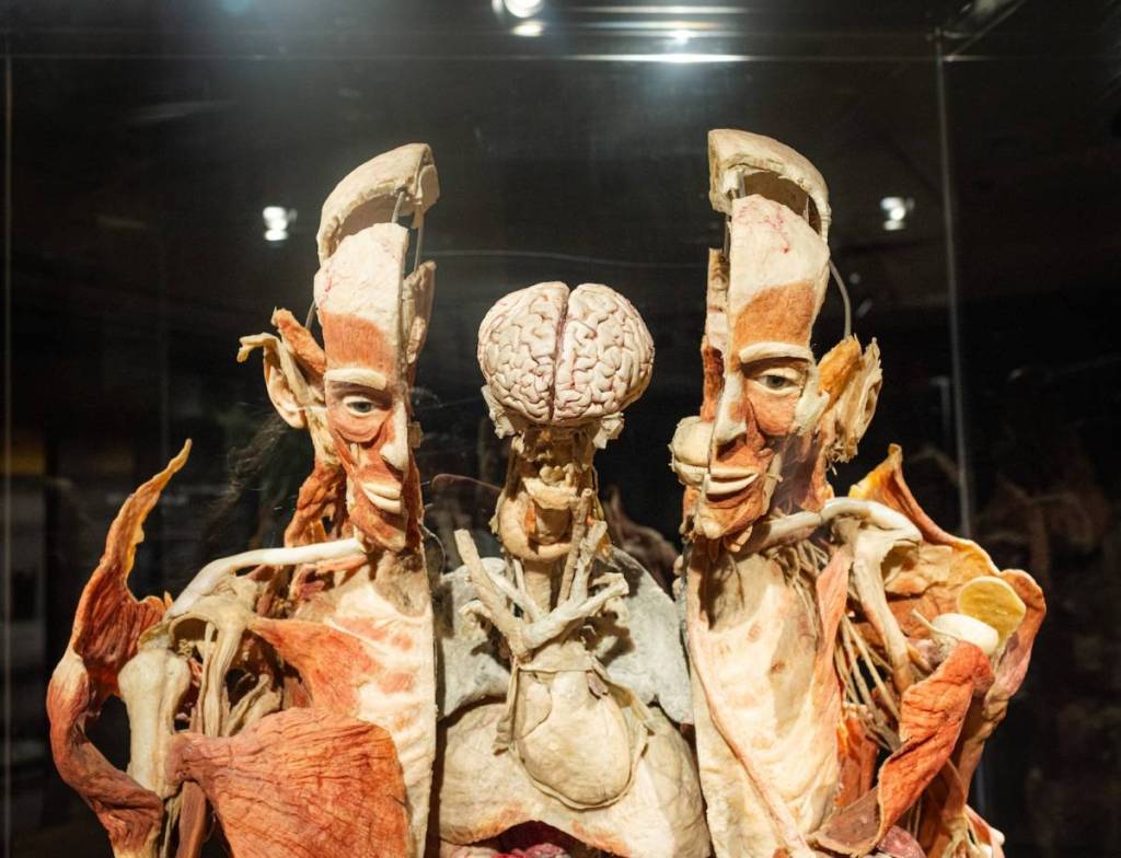 a plastinate of a person's head, with the skull cut in half to display the brain in the middle