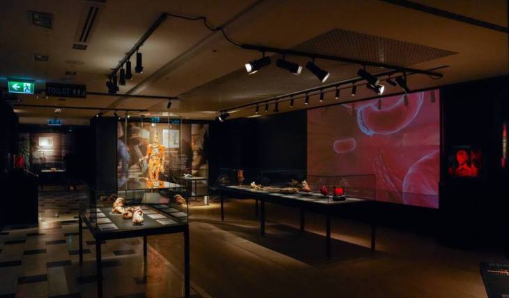 Hidden behind a red-brick façade of a South Kensington mansion, this new £20 exhibition displays real human bodies frozen in mid-backflip