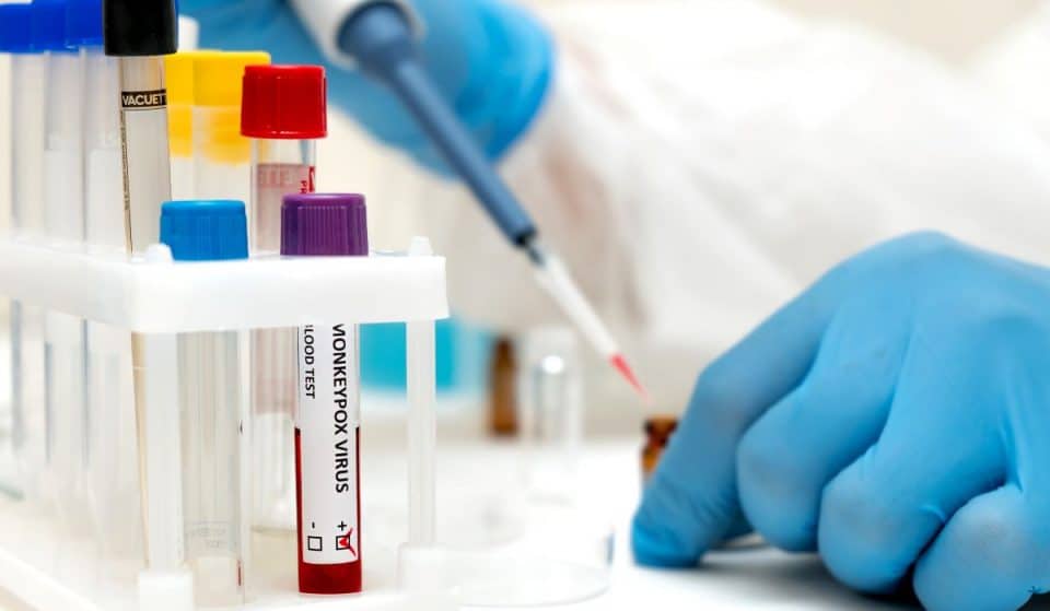 Monkeypox Was Declared A Public Health Emergency In SF – Here’s What To Know
