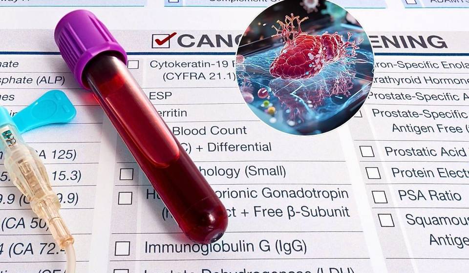 Eligible Singaporeans Can Book A Free Blood Test To Detect 10 Cancers Now 
