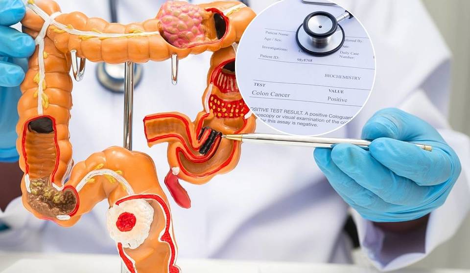 Eligible Singaporeans Can Get Free Colon Cancer Tests In 2026 & Here’s How