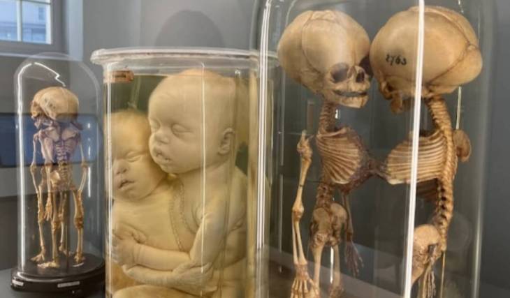 Located in the heart of Vienna, what was once the world’s first psychiatric hospital is now home to one of the city’s most bizarre museums, featuring 15,000 anatomical exhibits