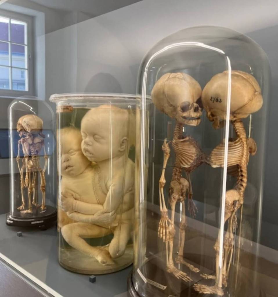 Skelette in der Pathologisch-anatomischen Sammlung im Narrenturm