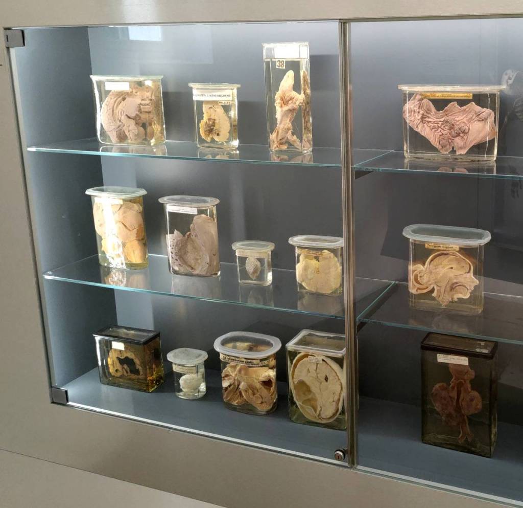 Die Pathologisch-Anatomische Sammlung im Narrenturm